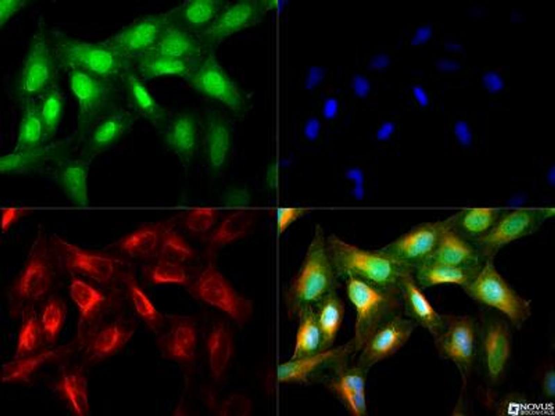 Immunocytochemistry/Immunofluorescence: MAP3K14 Antibody [NBP2-23603] - MAP3K14 antibody was tested in U2OS cells with DyLight 488 (green). Nuclei and alpha-tubulin were counterstained with DAPI (blue) and Dylight 550 (red).