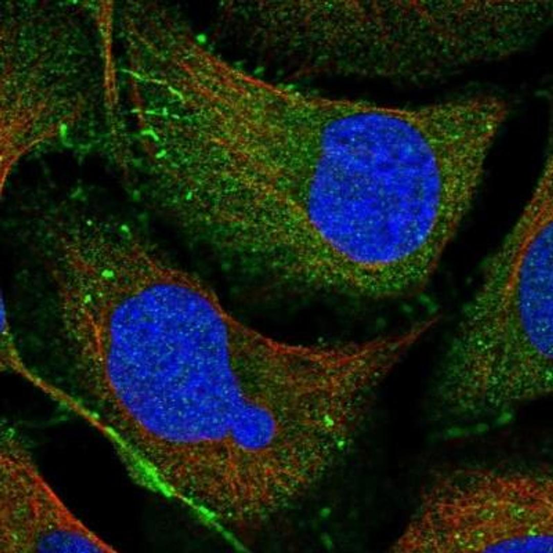 Immunocytochemistry/Immunofluorescence: PARD3/Par3 Antibody [NBP1-88861] - Staining of human cell line U-2 OS shows positivity in cell junctions.