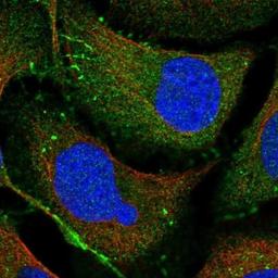 Immunocytochemistry/Immunofluorescence: PARD3/Par3 Antibody [NBP1-88861] - Staining of human cell line U-2 OS shows positivity in cell junctions.