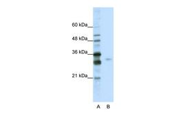 Antibody used in WB on Human HepG2 at 0.2-1 ug/ml.