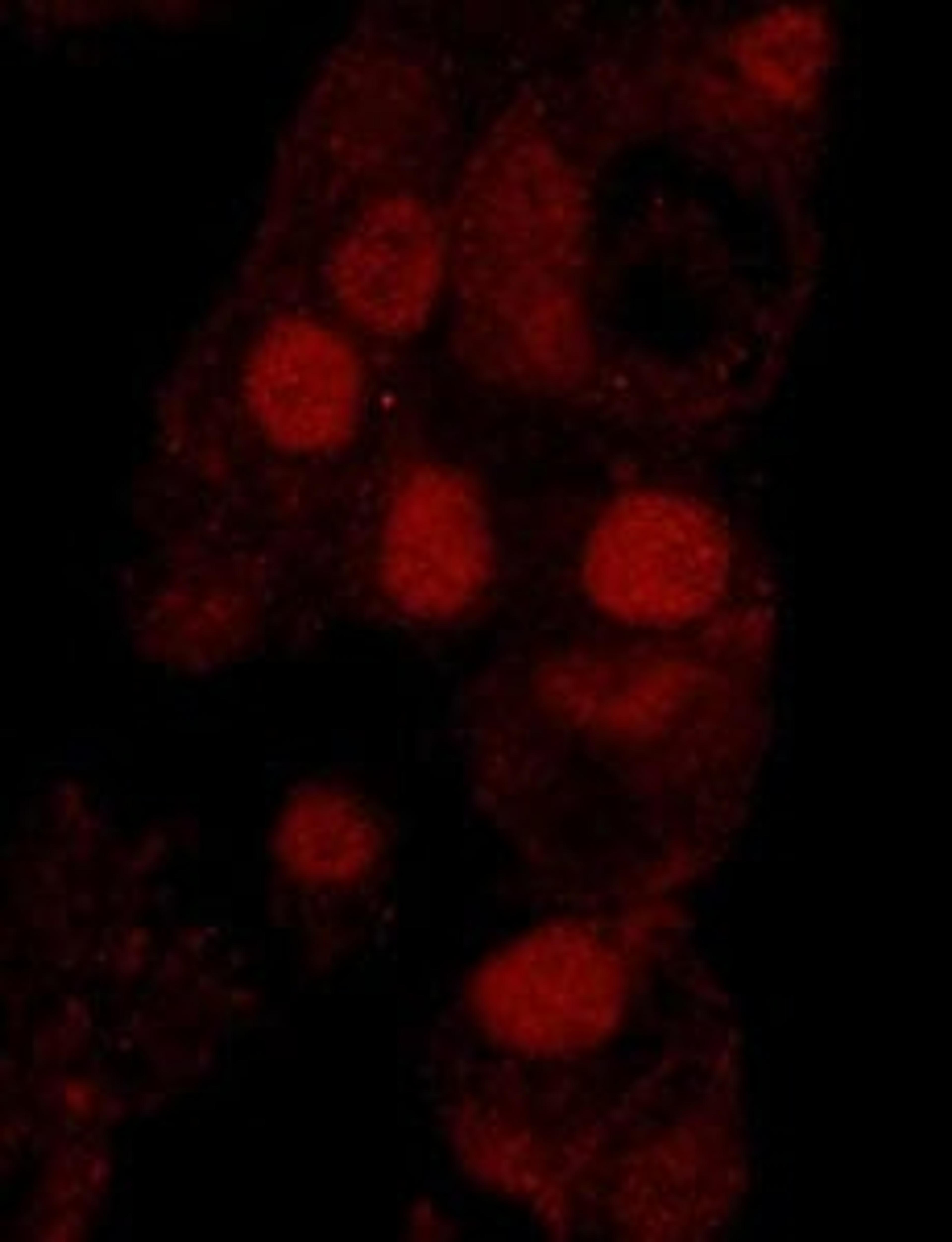 Detection of human WRNIP1 by immunohistochemistry.