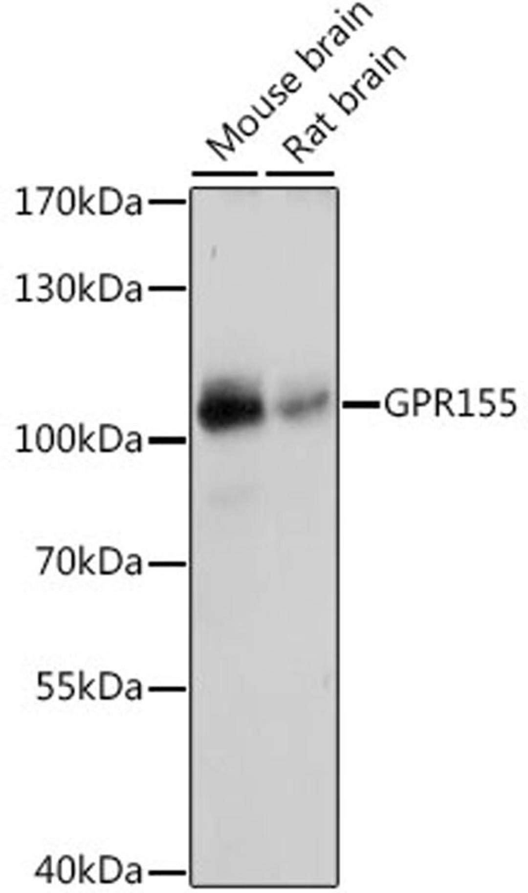 Western blot - GPR155 antibody (A16173)