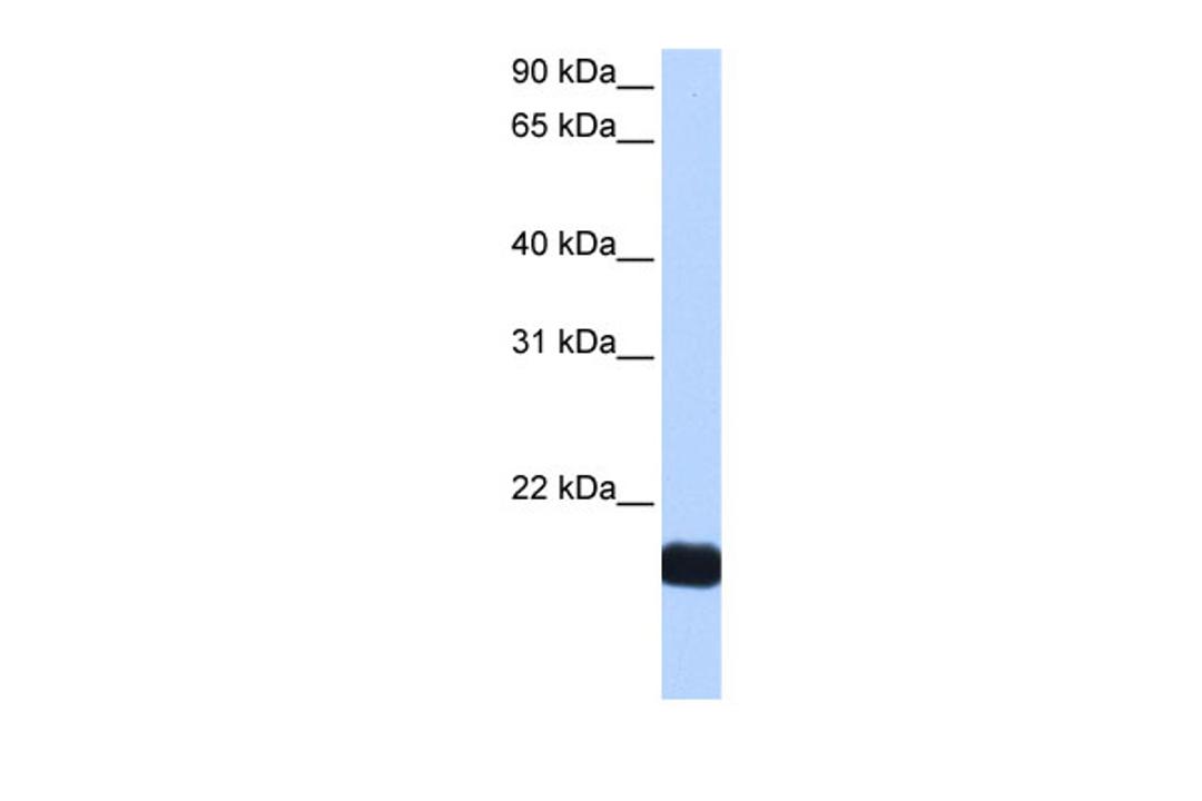 Antibody used in WB on Human HepG2 at 0.2-1 ug/ml.