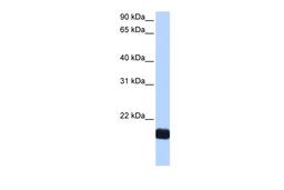 Antibody used in WB on Human HepG2 at 0.2-1 ug/ml.