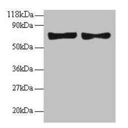 Western blot. All lanes: CCL5 antibody at 2µg/ml. Lane 1: EC109 whole cell lysate. Lane 2: 293T whole cell lysate. Secondary. Goat polyclonal to rabbit IgG at 1/15000 dilution. Predicted band size: 10 kDa. Observed band size: 70 kDa