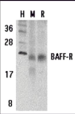 Western blot analysis of BAFF Receptor in human (H), mouse (M), and rat (R) spleen tissue lysates with BAFF Receptor antibody at 5 μg/mL.