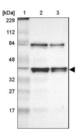 Western Blot: AUF1 Antibody [NBP1-88915] - Lane 1: Marker [kDa] 229, 112, 84, 48, 32, 27, 17<br/>Lane 2: Human cell line RT-4<br/>Lane 3: Human cell line U-251MG sp