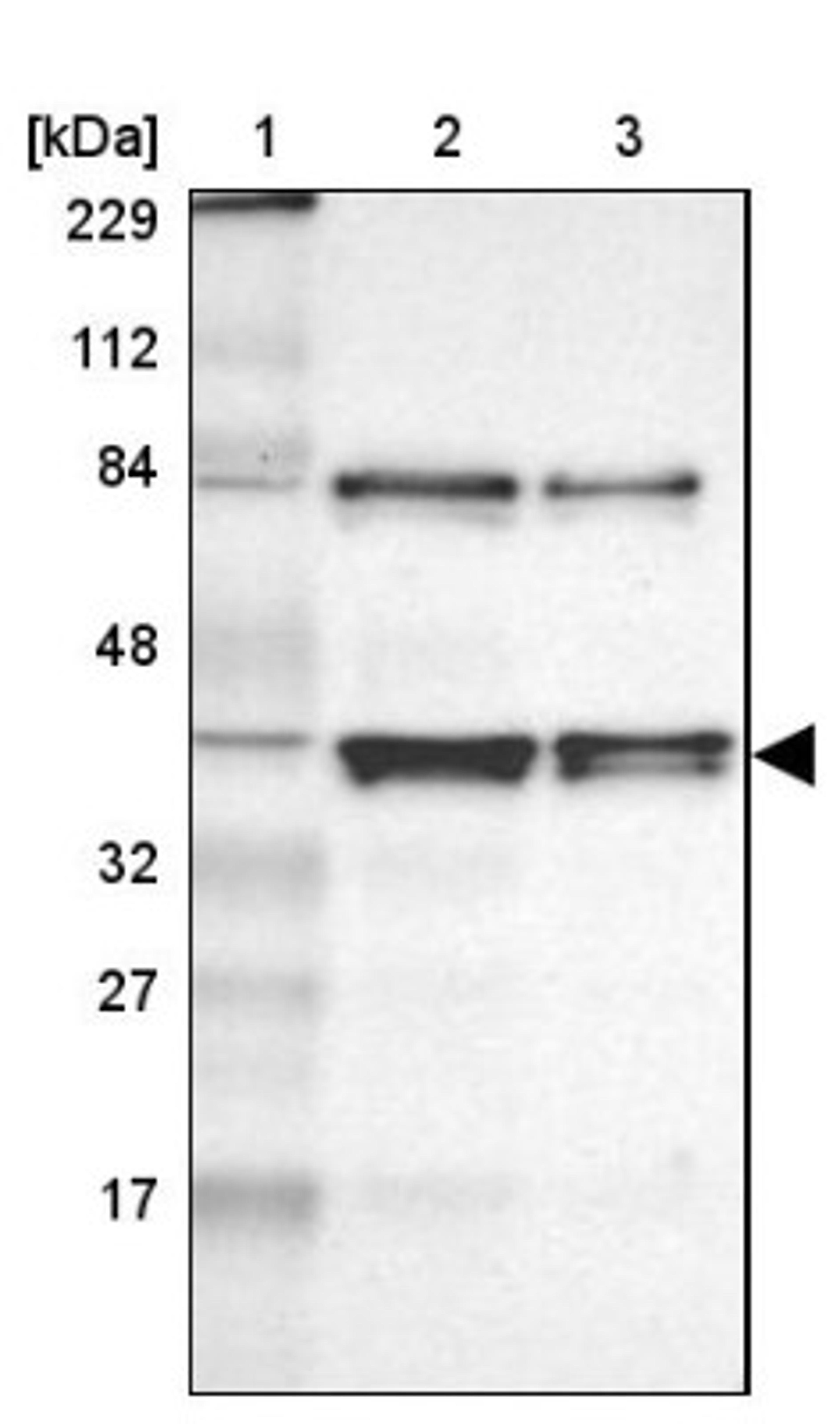 Western Blot: AUF1 Antibody [NBP1-88915] - Lane 1: Marker [kDa] 229, 112, 84, 48, 32, 27, 17<br/>Lane 2: Human cell line RT-4<br/>Lane 3: Human cell line U-251MG sp