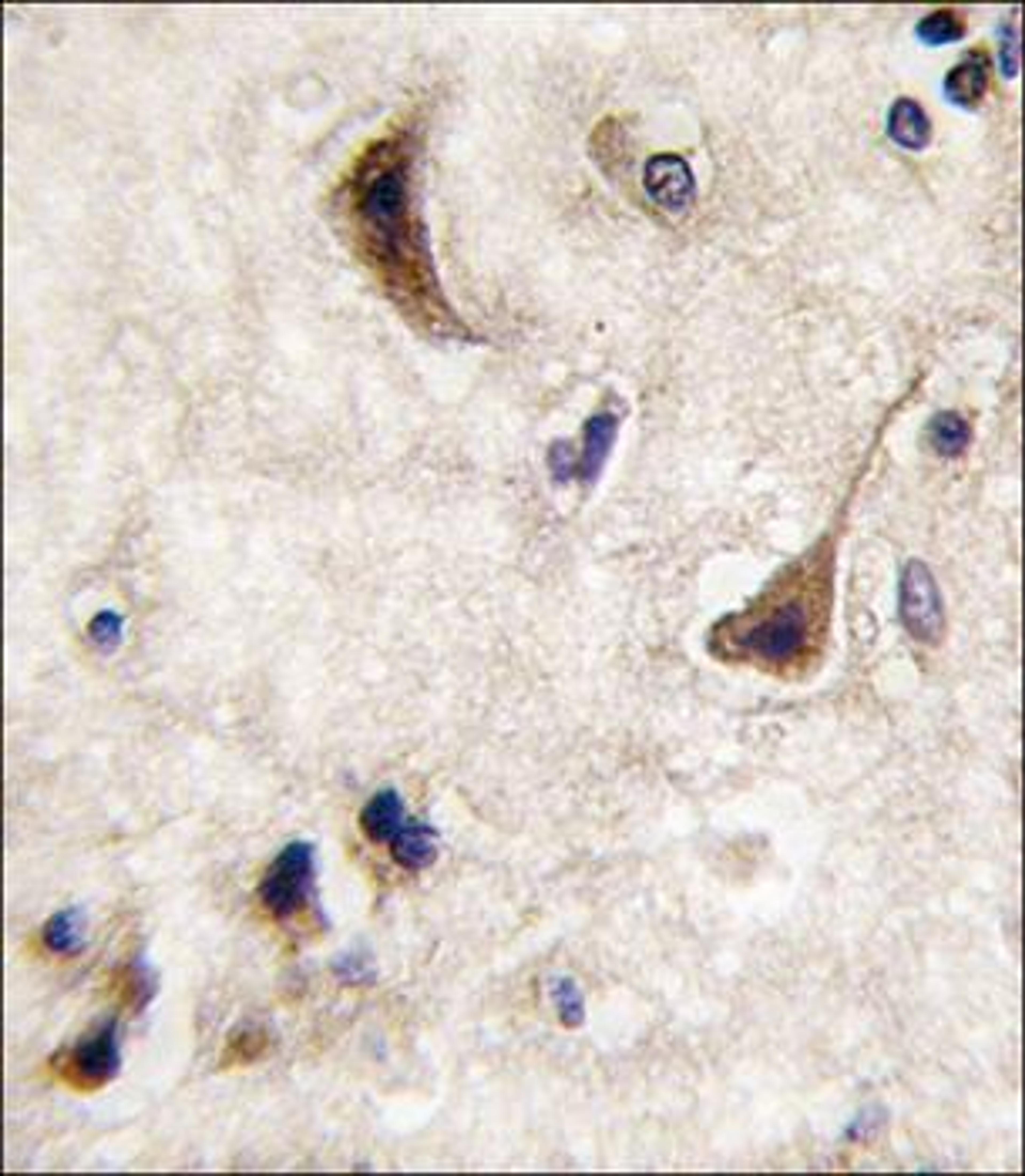 Immunohistochemical staining of paraffin embedded human brain tissue using STEP / PTPN5 antibody (primary antibody dilution at: 1:10-50)