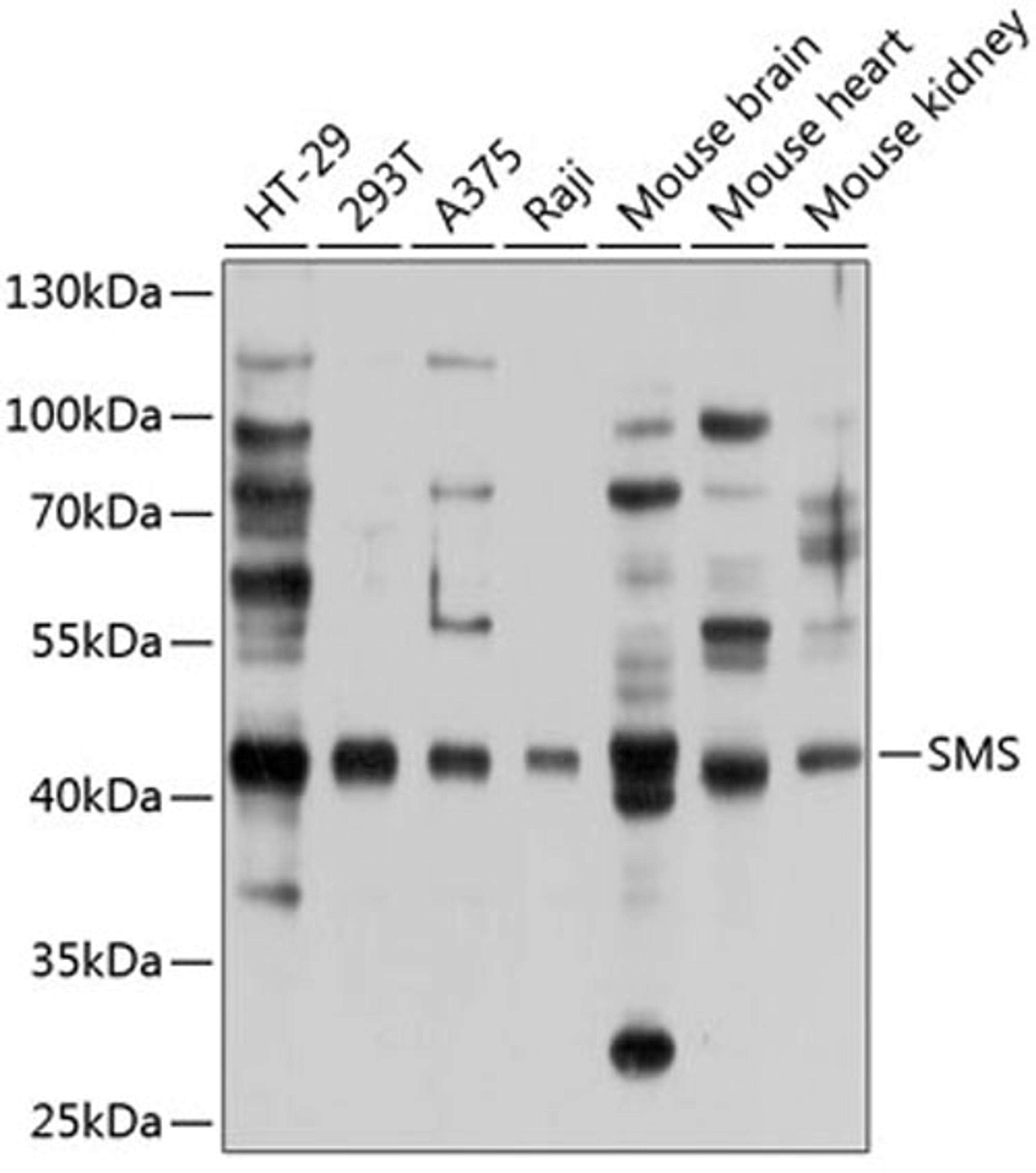 Western blot - SMS antibody (A9154)