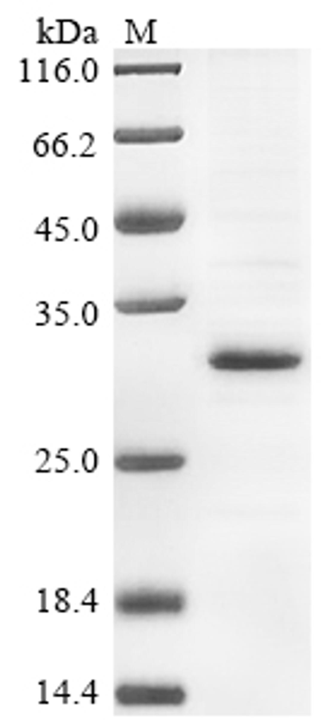 (Tris-Glycine gel) Discontinuous SDS-PAGE (reduced) with 5% enrichment gel and 15% separation gel.