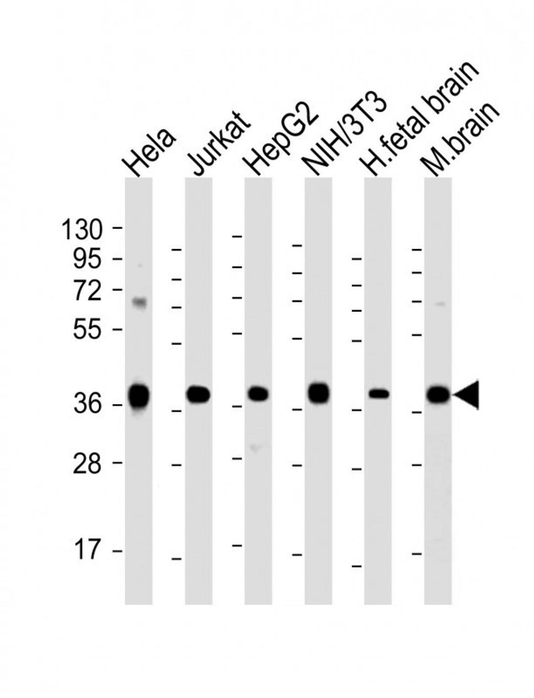 Western Blot at 1:2000 dilution Lane 1: Hela whole cell lysate Lane 2: Jurkat whole cell lysate Lane 3: HepG2 whole cell lysate Lane 4: NIH/3T3 whole cell lysate Lane 5: human fetal brain lysate Lane 6: mouse brain lysate Lysates/proteins at 20 ug per lan