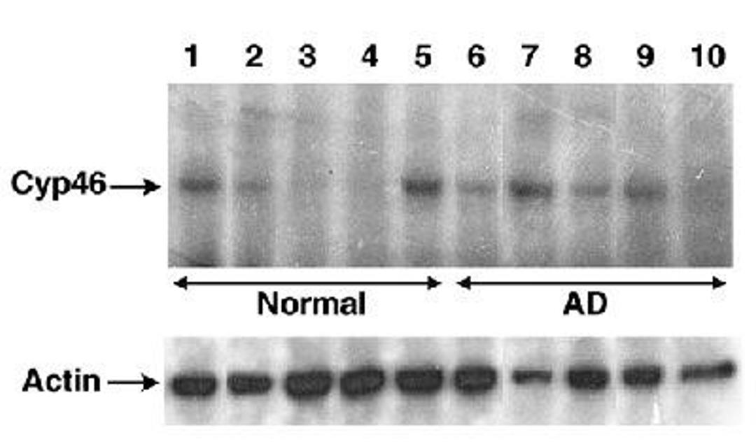 Western Blot: CYP46A1 Antibody [NB400-140] - Detection of Cyp46 in human brain lysates.