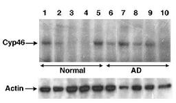 Western Blot: CYP46A1 Antibody [NB400-140] - Detection of Cyp46 in human brain lysates.