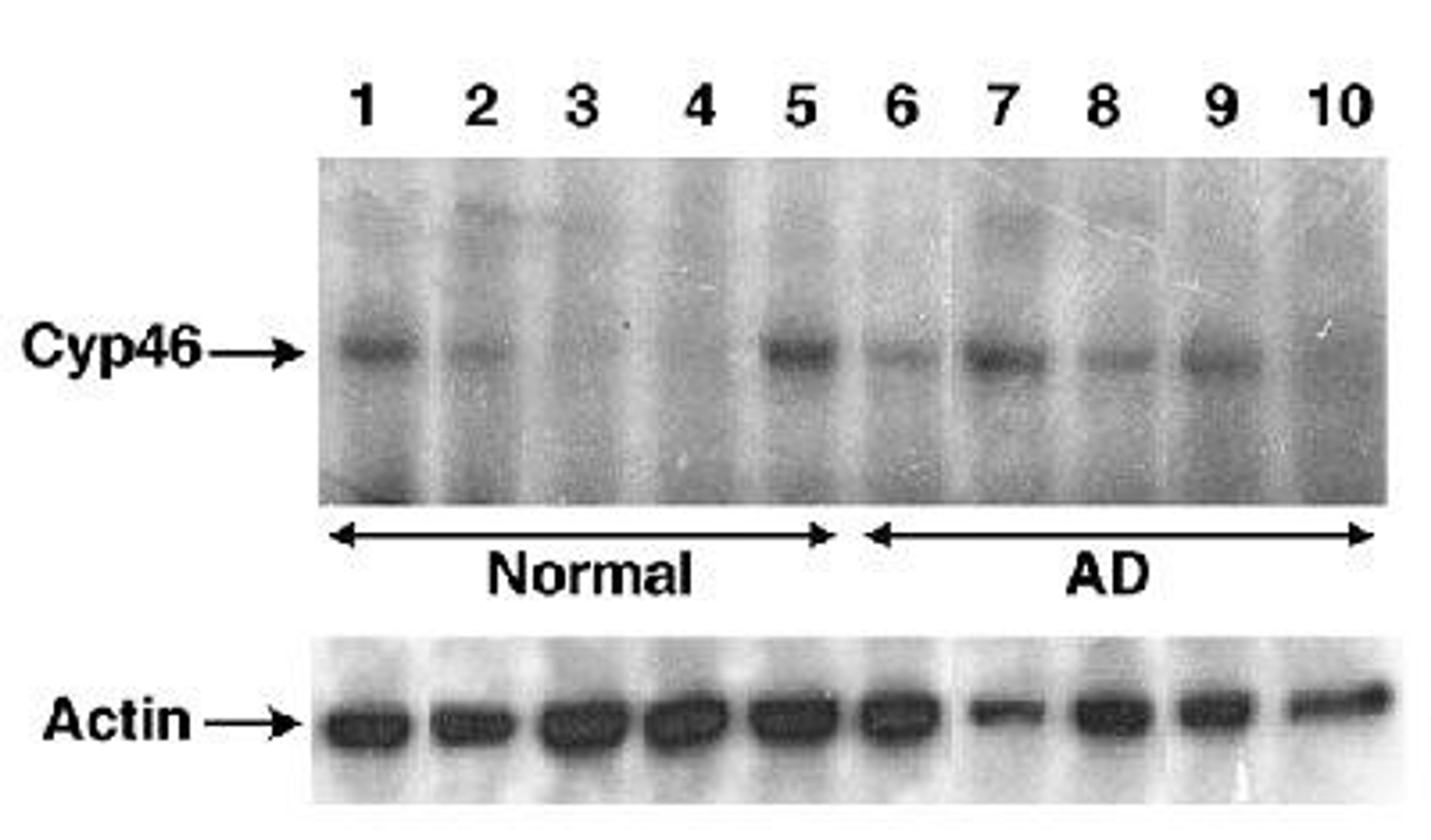 Western Blot: CYP46A1 Antibody [NB400-140] - Detection of Cyp46 in human brain lysates.