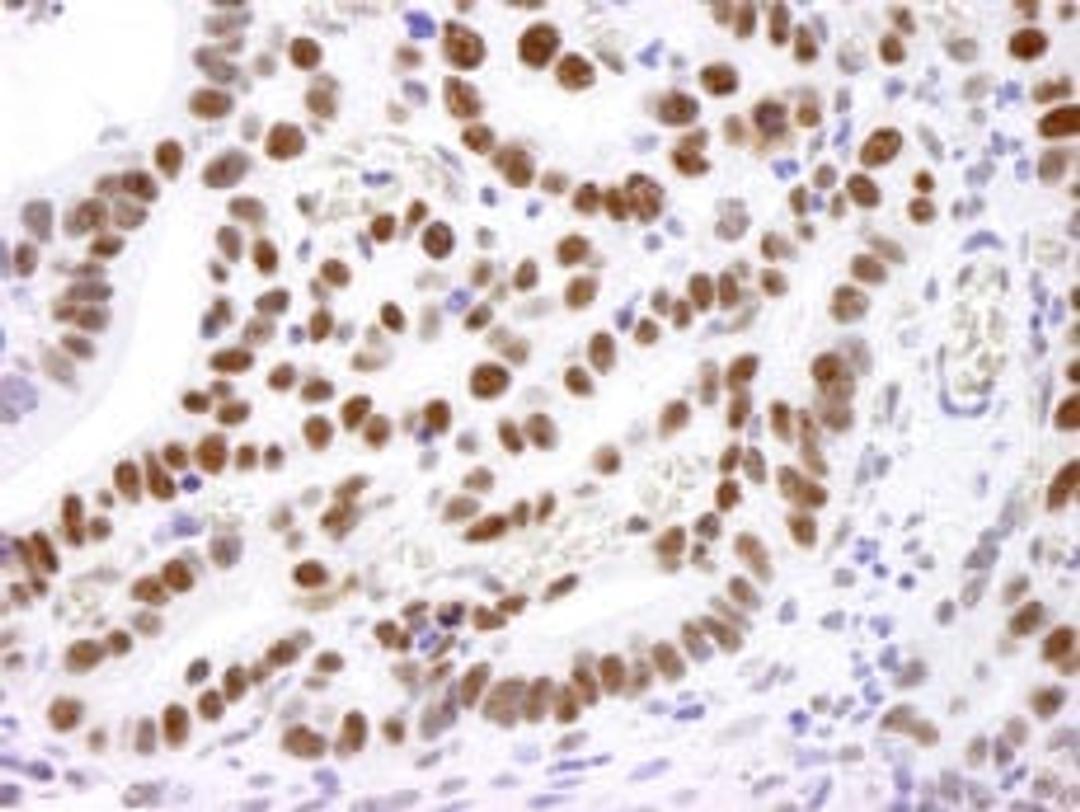 Detection of human Nucleolin by immunohistochemistry.