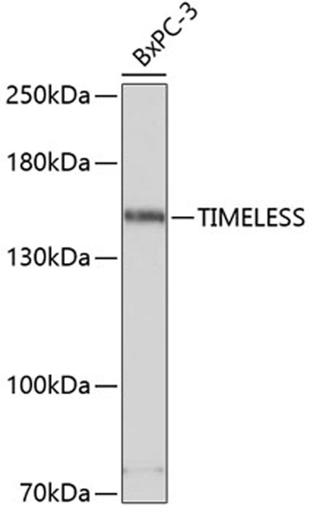 Western blot - TIMELESS antibody (A4261)