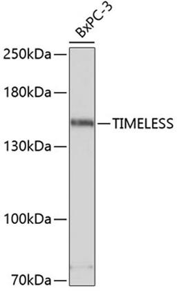 Western blot - TIMELESS antibody (A4261)