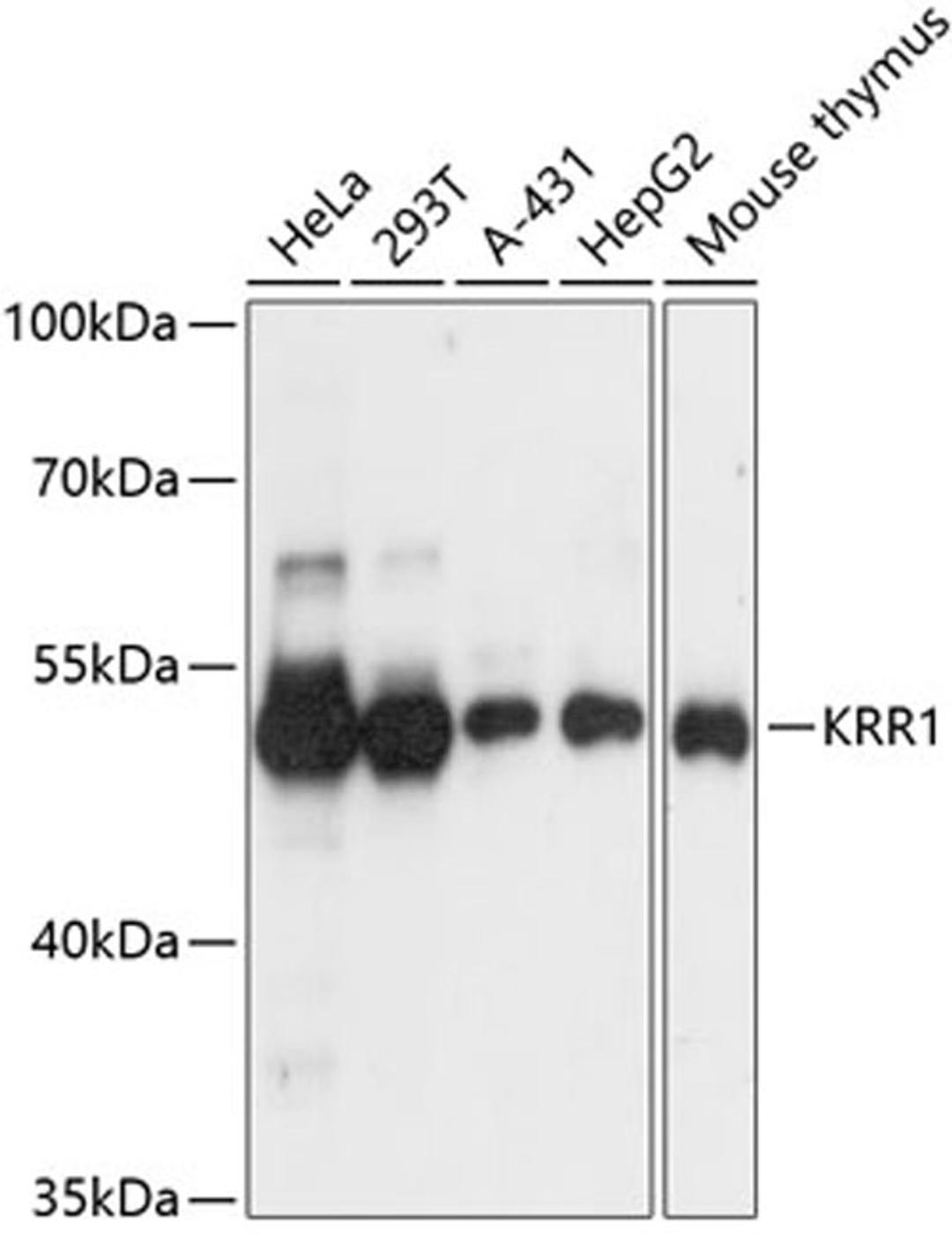 Western blot - KRR1 antibody (A4487)