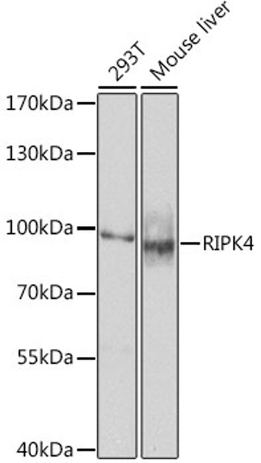 Western blot - RIPK4 antibody (A8495)