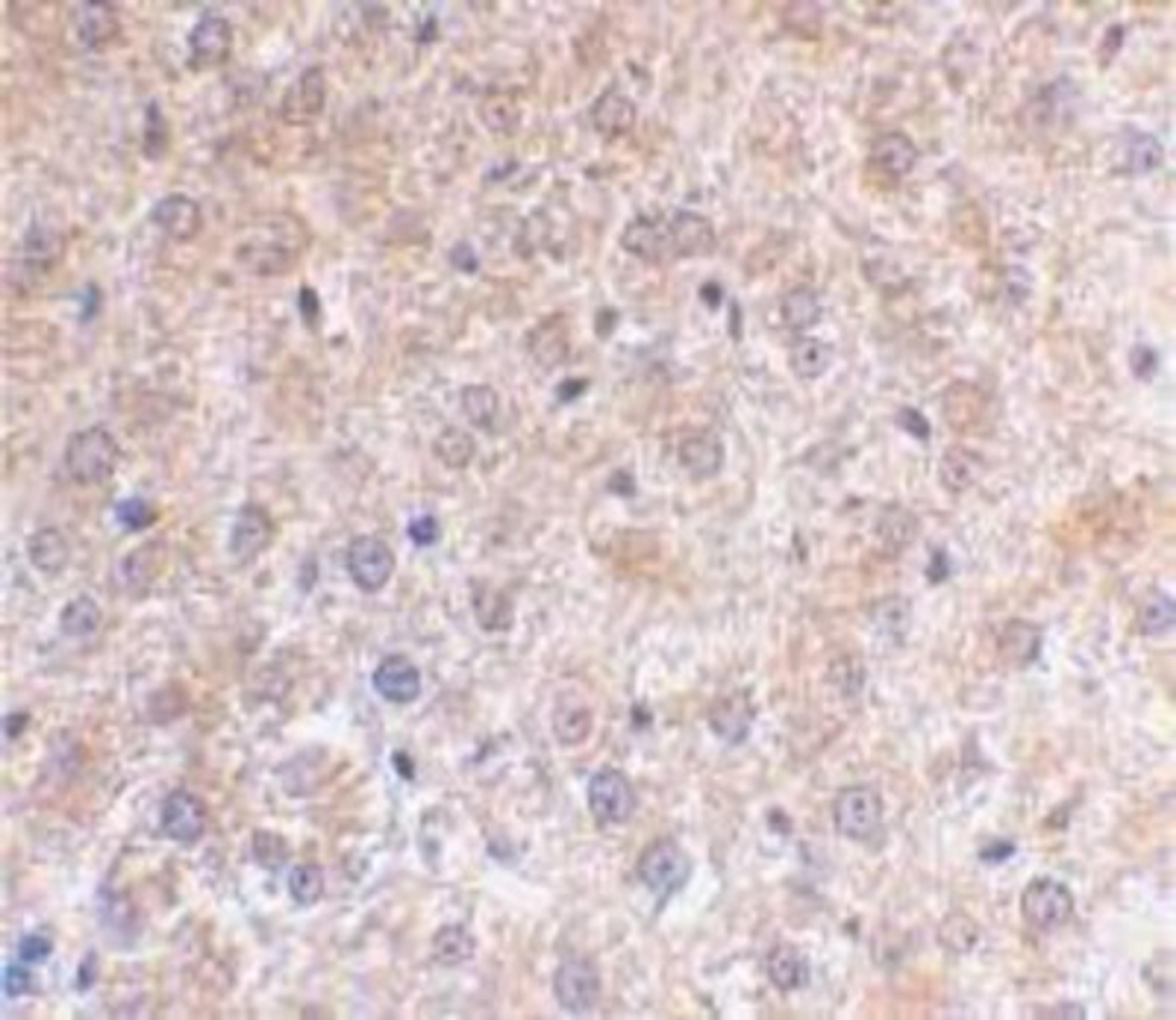 Immunohistochemistry-Paraffin: p53 DINP1 Antibody [NBP1-76638] - Mouse liver using p53DINP1 antibody at 2 ug/ml.