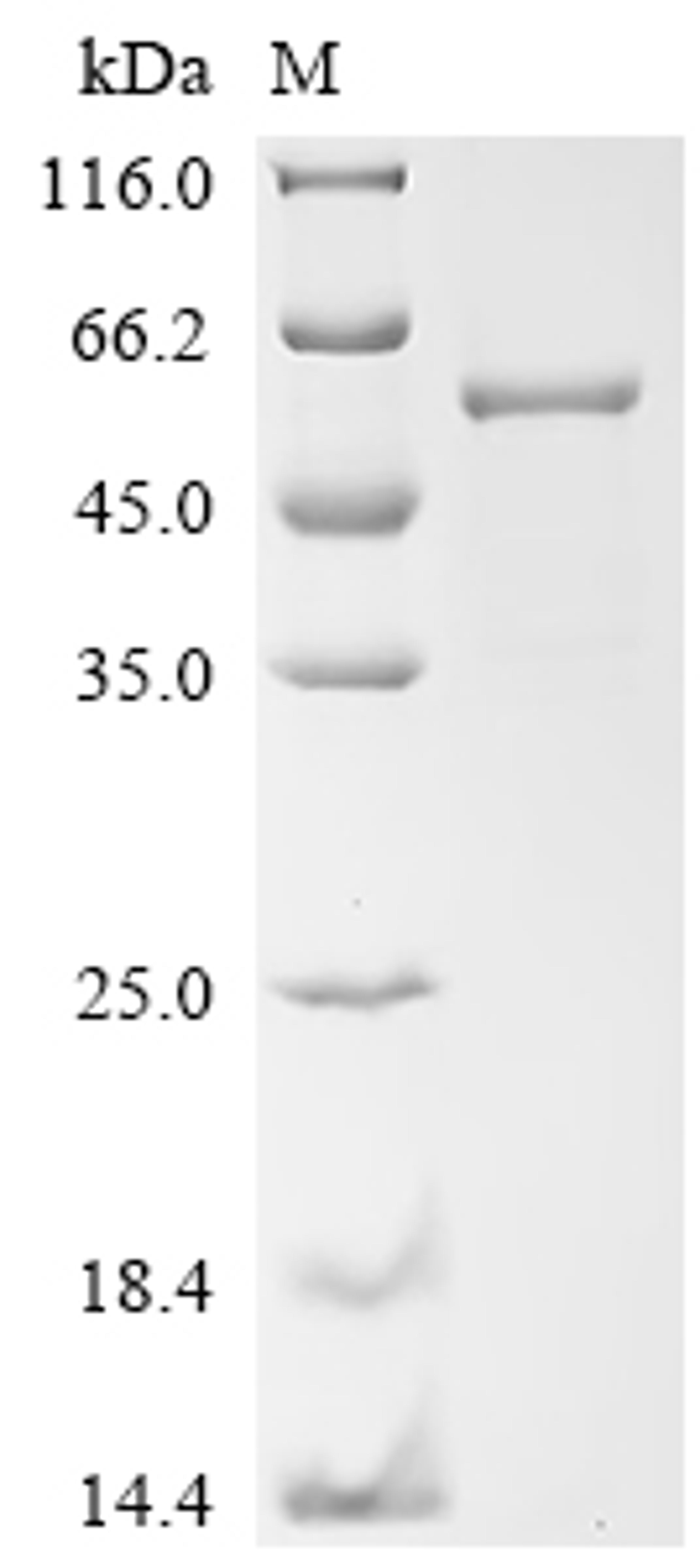 (Tris-Glycine gel) Discontinuous SDS-PAGE (reduced) with 5% enrichment gel and 15% separation gel.