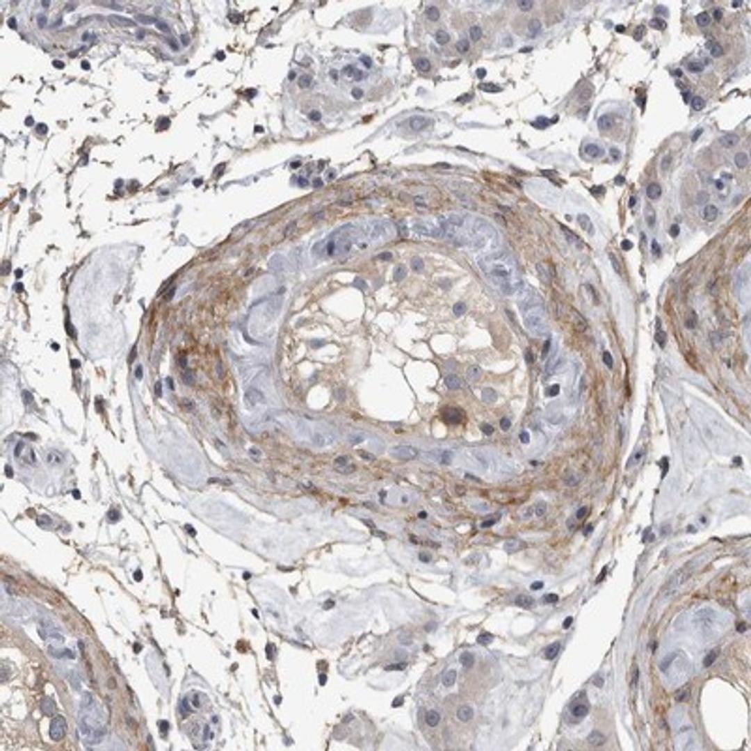 Immunohistochemistry-Paraffin: EFEMP2 Antibody [NBP1-84724] - Staining of human testis shows distinct positivity in the fibrous capsule around seminiferous ducts.