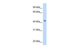 Antibody used in WB on Transfected 293T at 5.0 ug/ml.