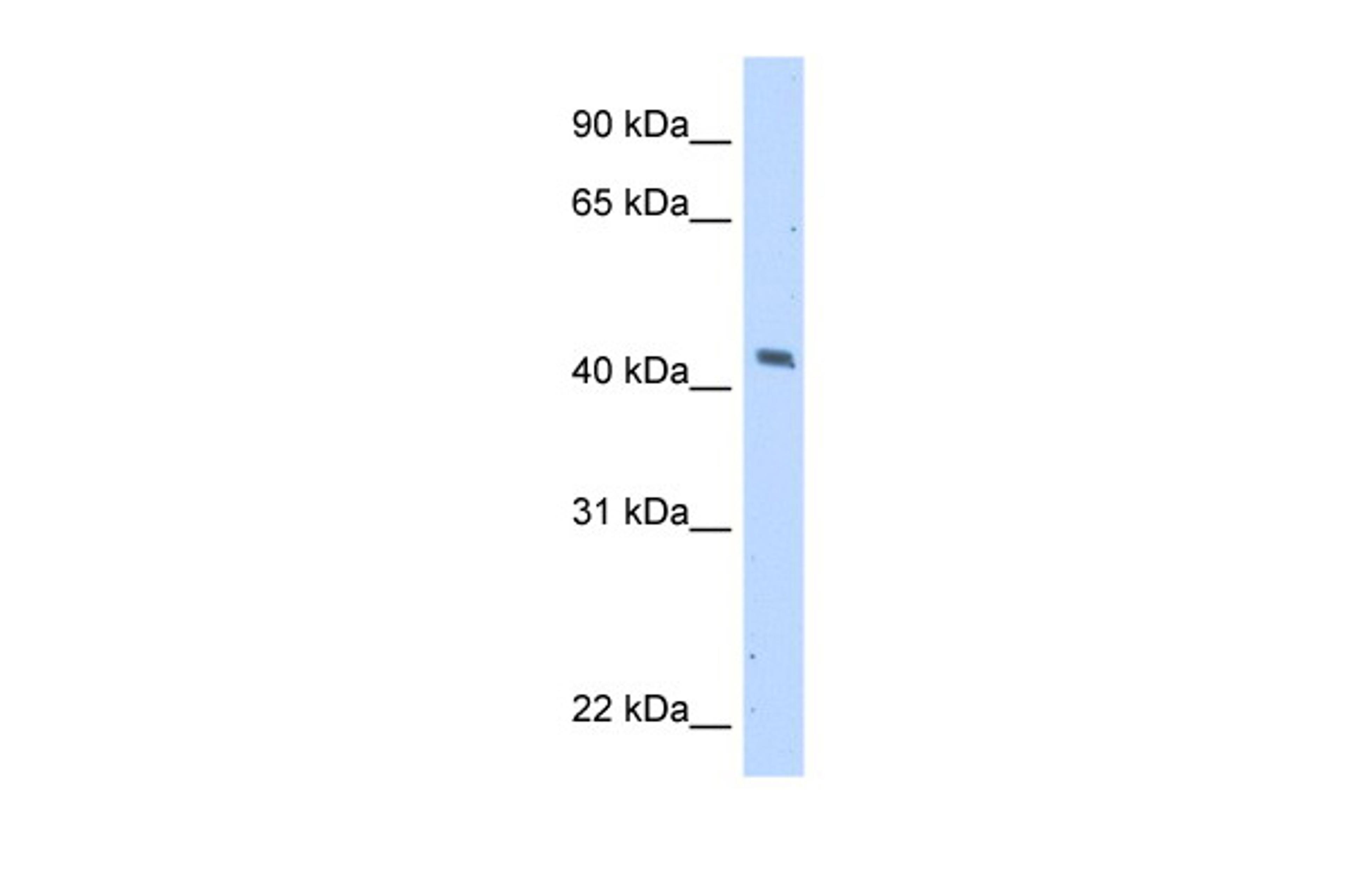 Antibody used in WB on Transfected 293T at 5.0 ug/ml.