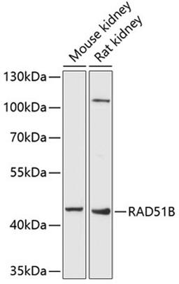 Western blot - RAD51B antibody (A6962)