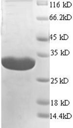 (Tris-Glycine gel) Discontinuous SDS-PAGE (reduced) with 5% enrichment gel and 15% separation gel.