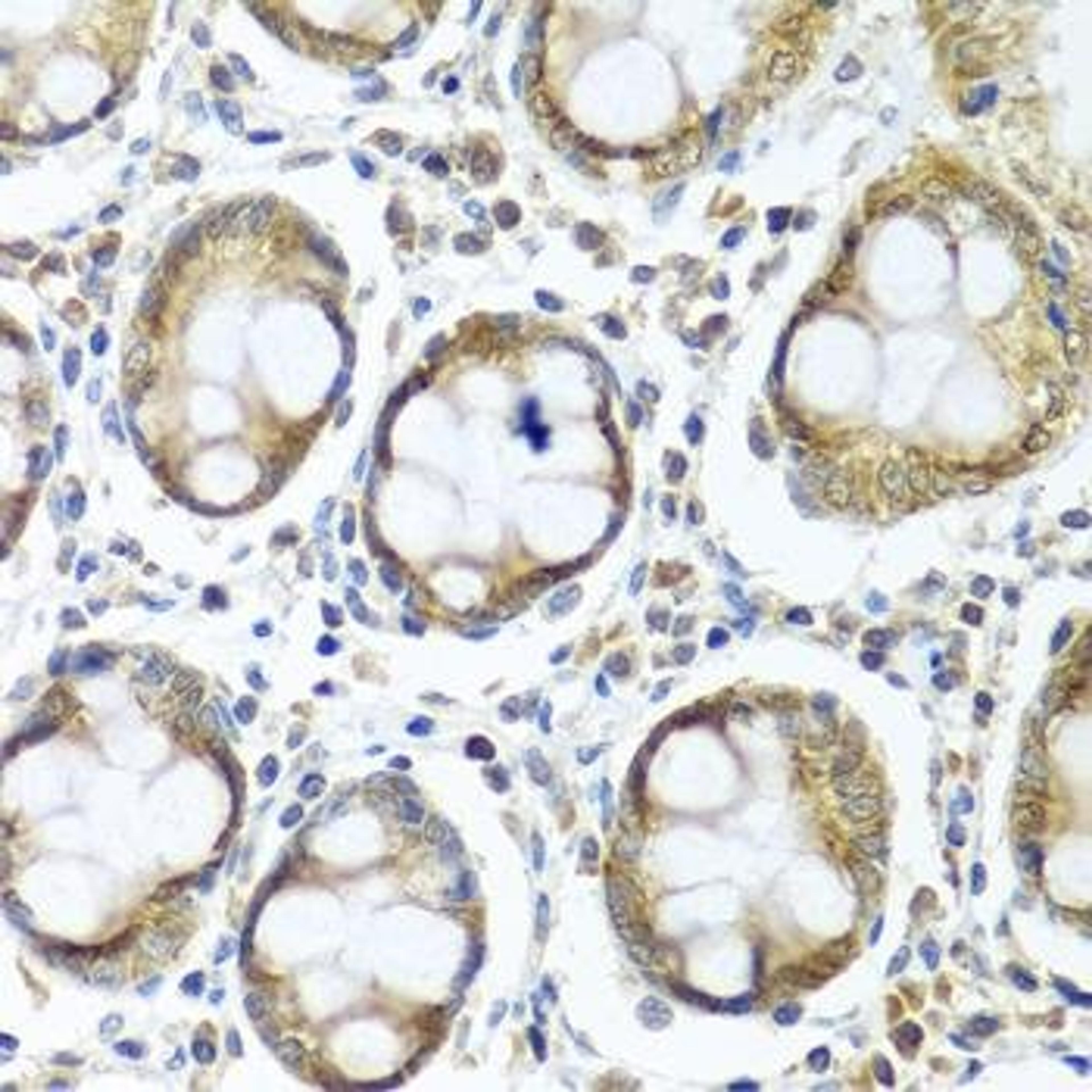 Immunohistochemical staining of human colon tissue using IFI44 antibody (dilution of 1:100)