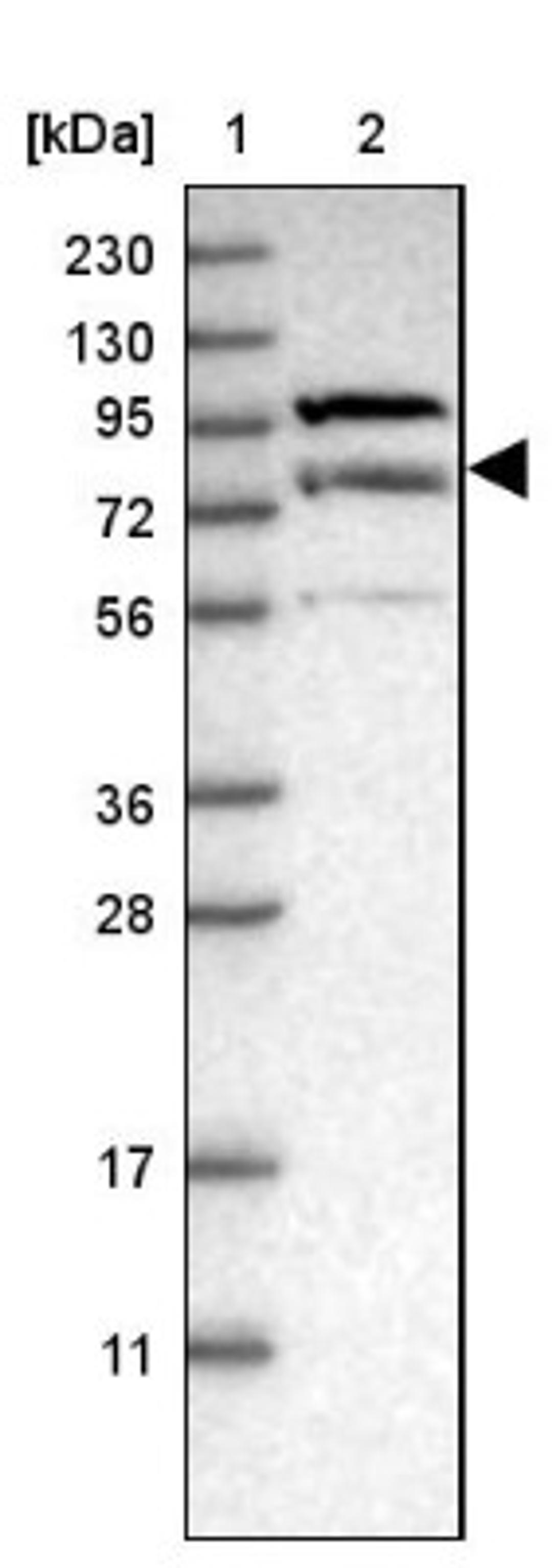 Western Blot: LRSAM1 Antibody [NBP1-82016] - Lane 1: Marker [kDa] 230, 130, 95, 72, 56, 36, 28, 17, 11<br/>Lane 2: Human cell line RT-4