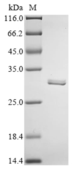 (Tris-Glycine gel) Discontinuous SDS-PAGE (reduced) with 5% enrichment gel and 15% separation gel.