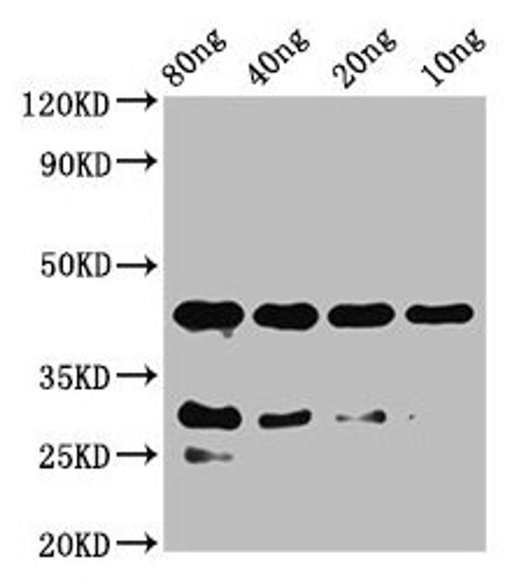 Western Blot. Positive WB detected in Recombinant protein. All lanes: notchl antibody at 2µg/ml. Secondary. Goat polyclonal to rabbit IgG at 1/50000 dilution. Predicted band size: 42 kDa. Observed band size: 42 kDa