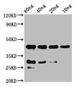 Western Blot. Positive WB detected in Recombinant protein. All lanes: notchl antibody at 2µg/ml. Secondary. Goat polyclonal to rabbit IgG at 1/50000 dilution. Predicted band size: 42 kDa. Observed band size: 42 kDa