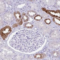 Immunohistochemistry-Paraffin: PSCA Antibody [NBP2-33786] - Staining of human kidney shows strong cytoplasmic and membranous positivity in subset of renal tubules.