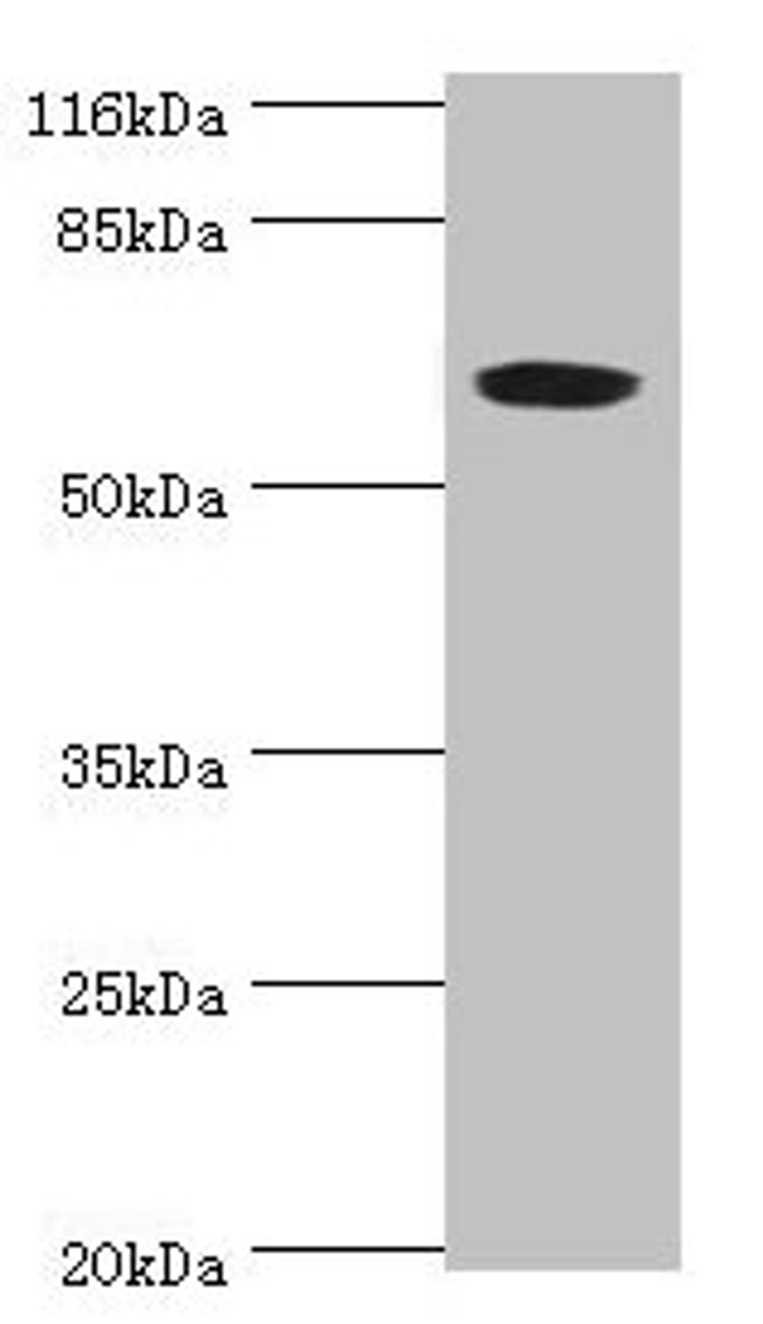 Western blot. All lanes: SLC13A4 antibody at 2ug/ml + 293T whole cell lysate. Secondary. Goat polyclonal to rabbit IgG at 1/10000 dilution. Predicted band size: 69 kDa. Observed band size: 69 kDa. 