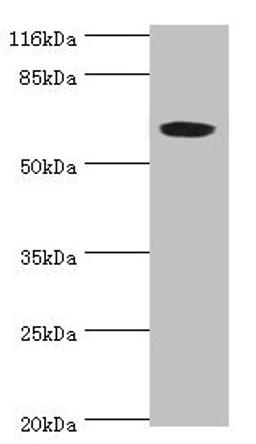 Western blot. All lanes: SLC13A4 antibody at 2ug/ml + 293T whole cell lysate. Secondary. Goat polyclonal to rabbit IgG at 1/10000 dilution. Predicted band size: 69 kDa. Observed band size: 69 kDa. 