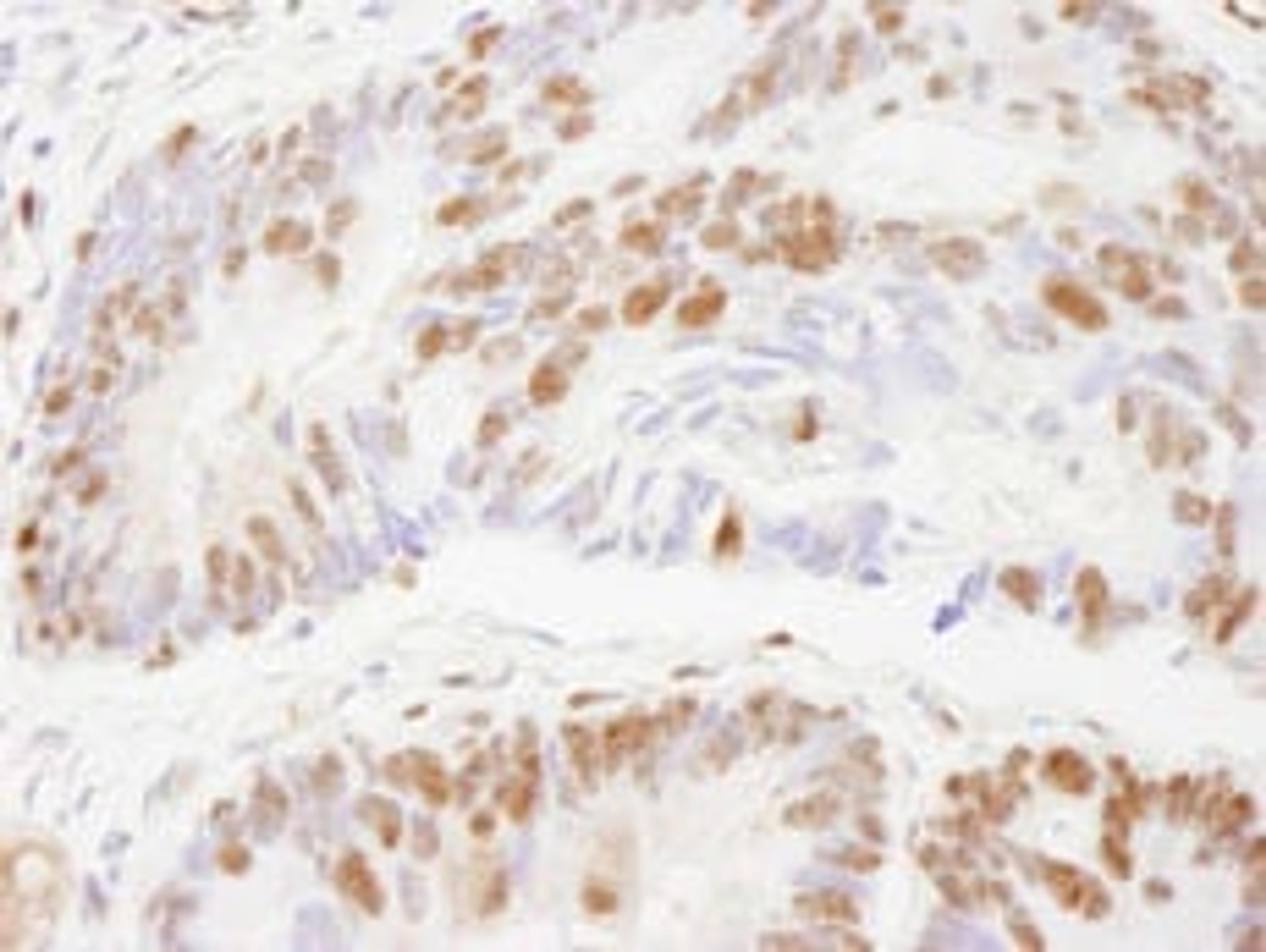 Detection of human ZNF295 by immunohistochemistry.