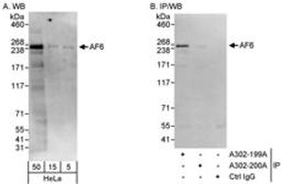 Detection of human AF6 by western blot and immunoprecipitation.