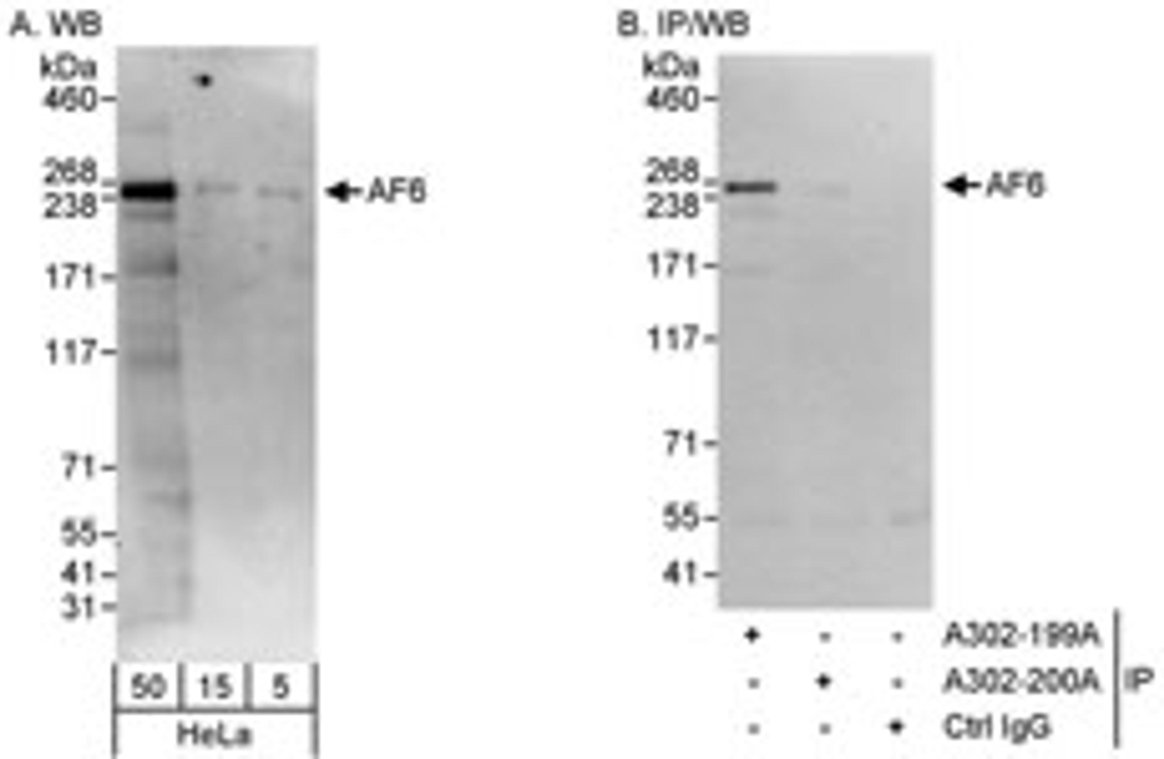 Detection of human AF6 by western blot and immunoprecipitation.