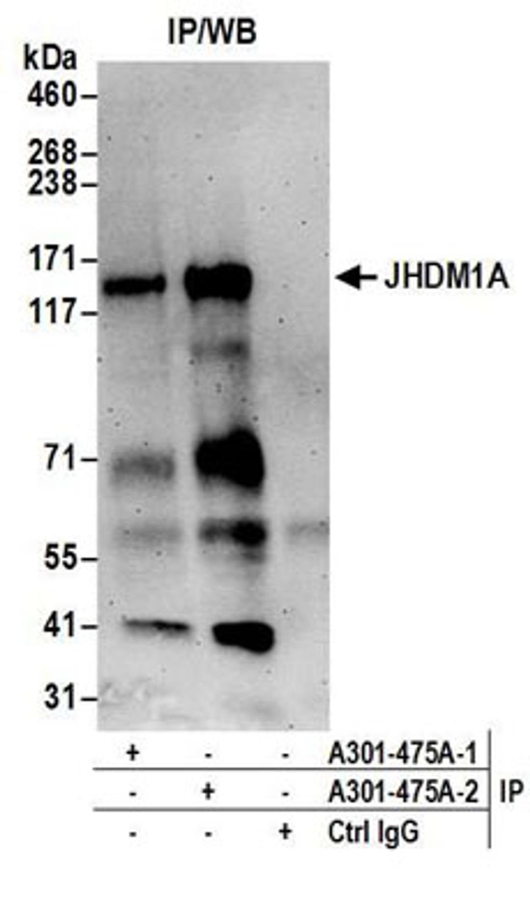 Detection of human JHDM1A by western blot of immunoprecipitates.