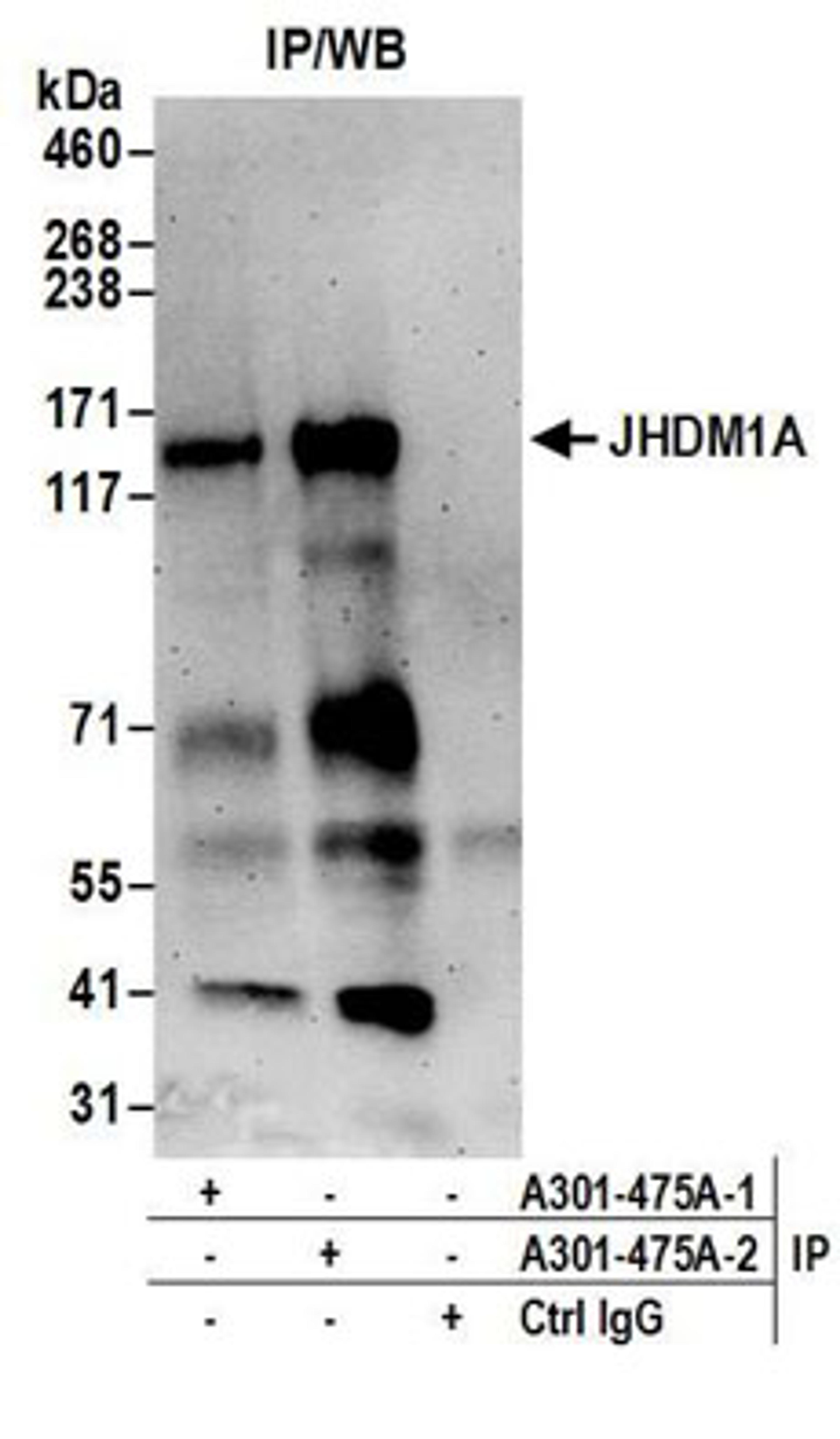 Detection of human JHDM1A by western blot of immunoprecipitates.