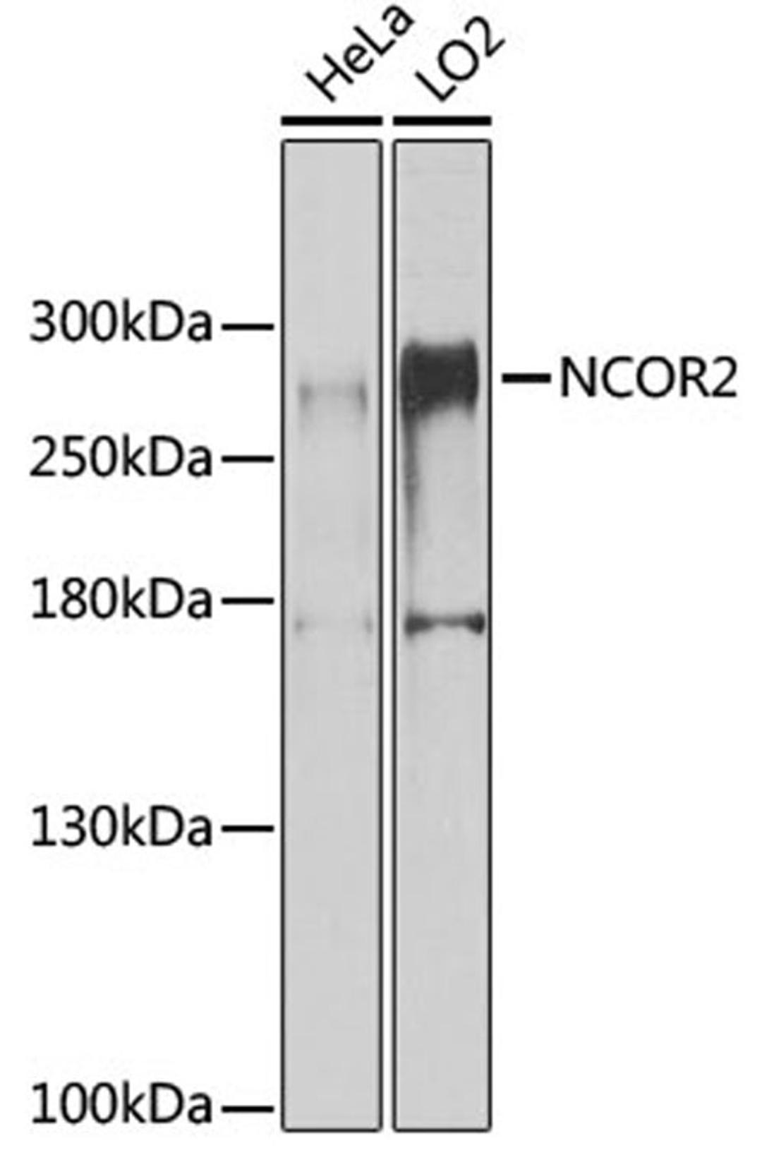 Western blot - NCOR2 antibody (A8388)