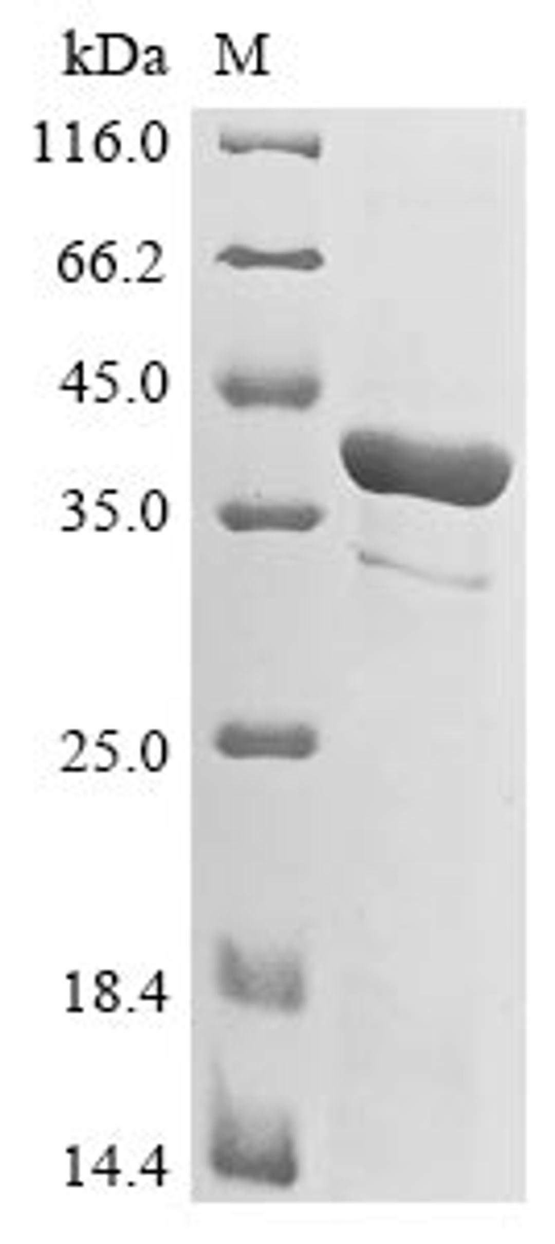 (Tris-Glycine gel) Discontinuous SDS-PAGE (reduced) with 5% enrichment gel and 15% separation gel.