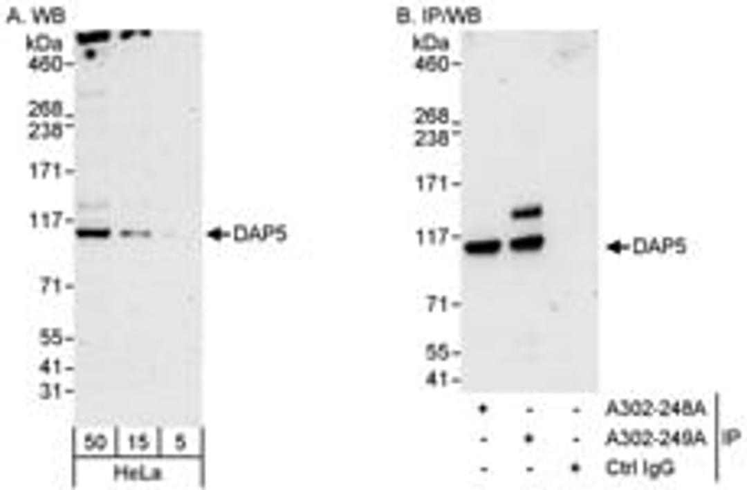 Detection of human DAP5 by western blot and immunoprecipitation.