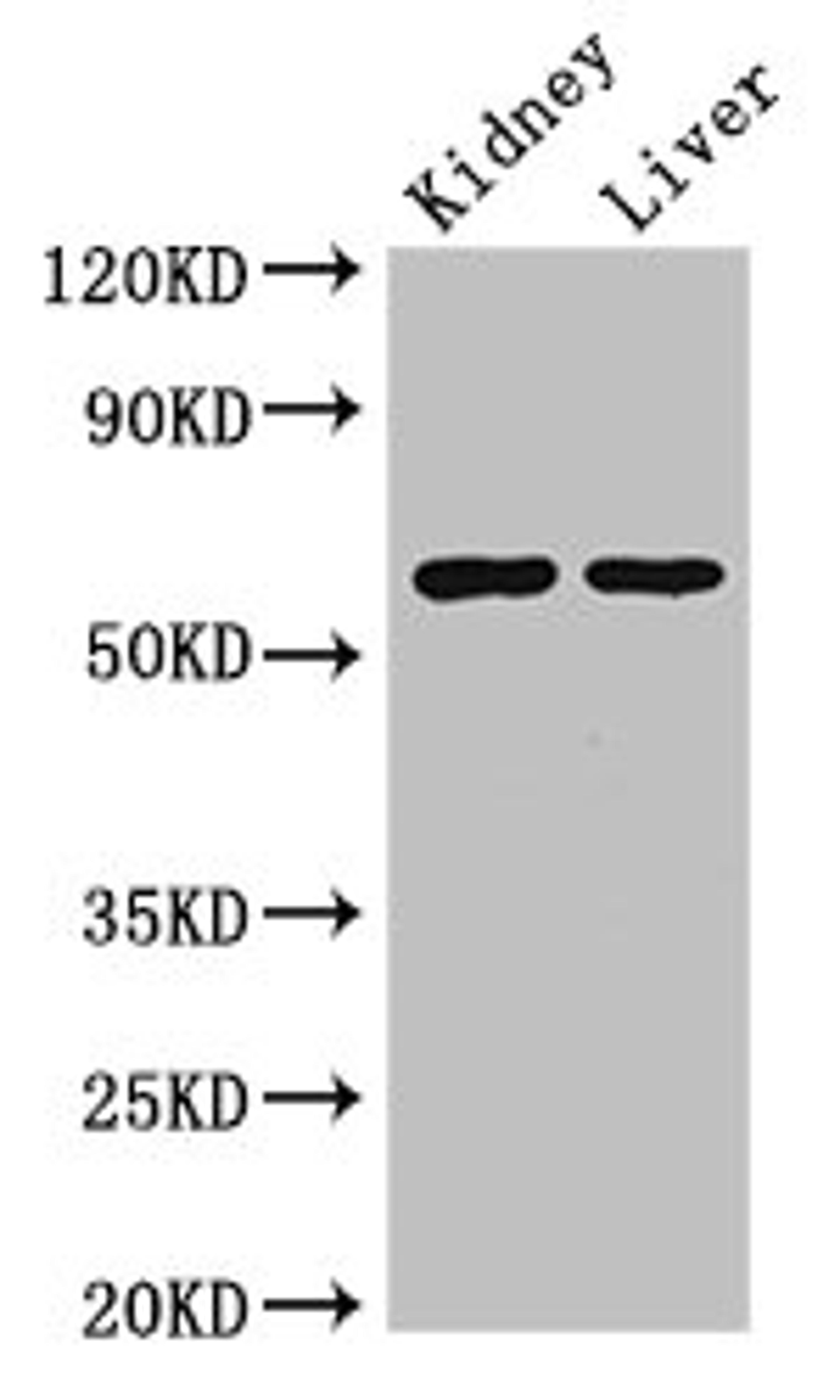 Western Blot. Positive WB detected in: Mouse kidney tissue, Mouse liver tissue. All lanes: ALDH6A1 antibody at 2.5ug/ml. Secondary. Goat polyclonal to rabbit IgG at 1/50000 dilution. Predicted band size: 58, 57 kDa. Observed band size: 58 kDa. 