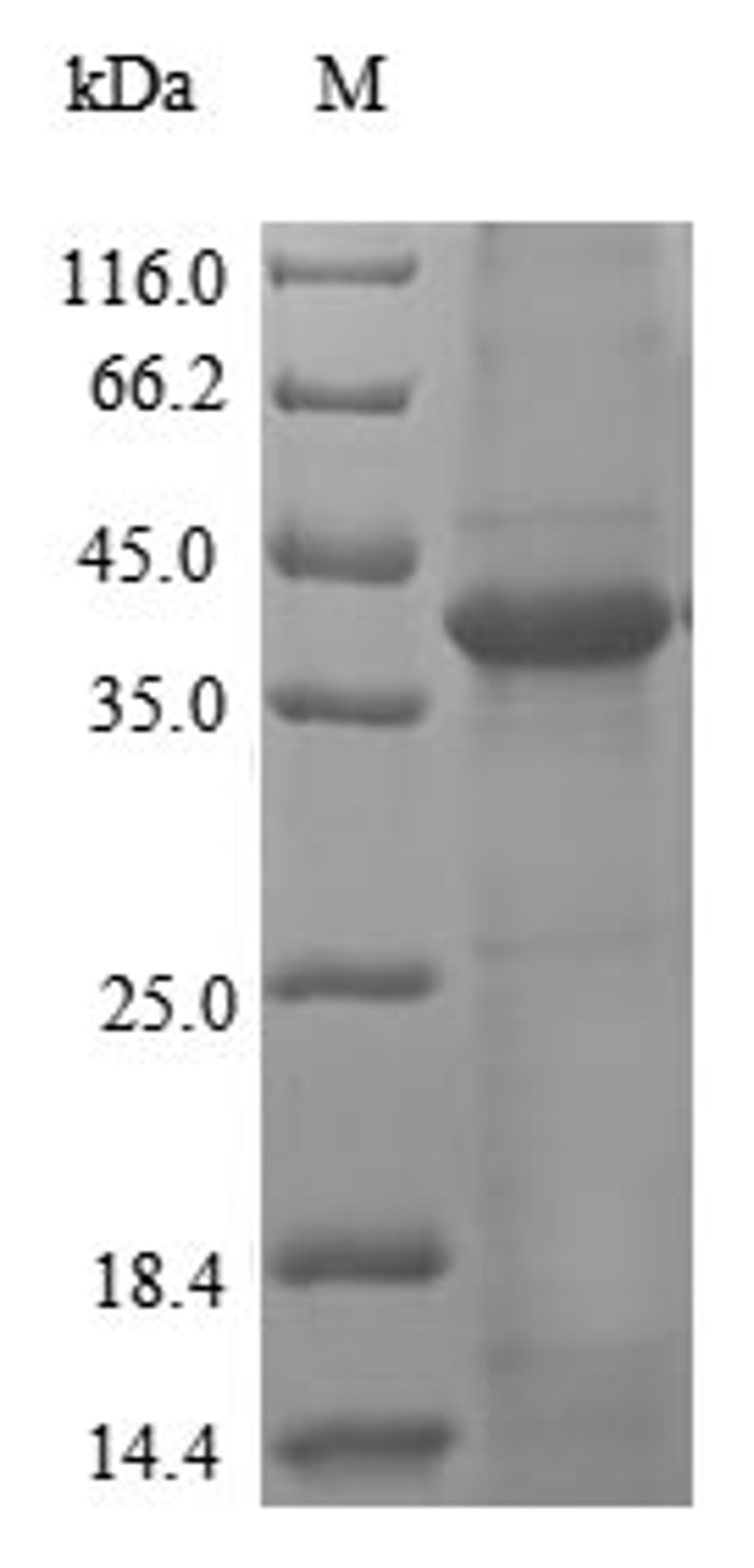 (Tris-Glycine gel) Discontinuous SDS-PAGE (reduced) with 5% enrichment gel and 15% separation gel.