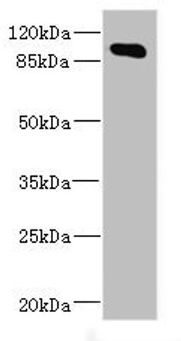 Western blot. All lanes: MAP4K5 antibody at 4.2ug/ml + Mouse brain tissue. Secondary. Goat polyclonal to rabbit IgG at 1/10000 dilution. Predicted band size: 95 kDa. Observed band size: 95 kDa. 